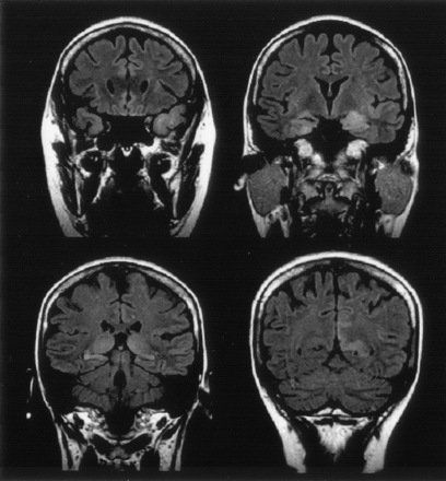 Fig 6.