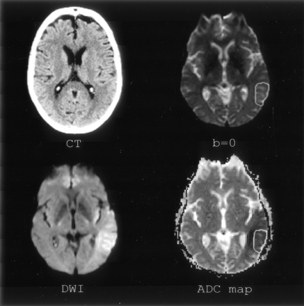 Fig 1.