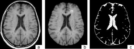 Fig 2.