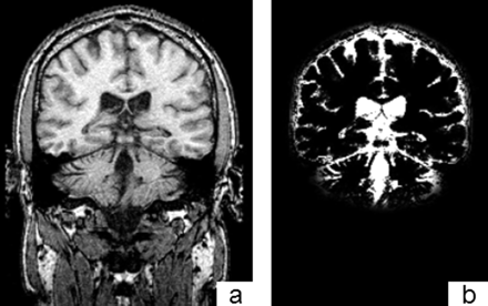 Fig 3.