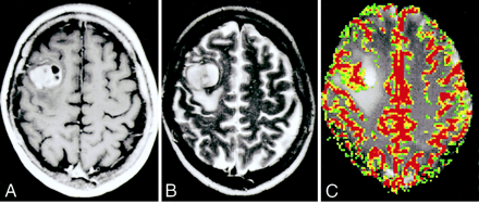 Fig 1.