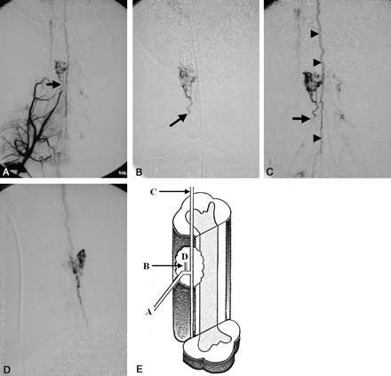 Fig 2.