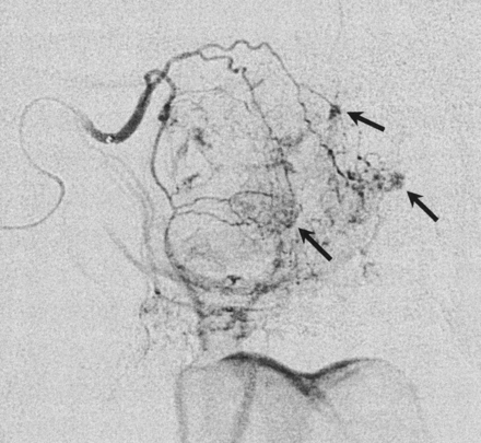 Fig 1.