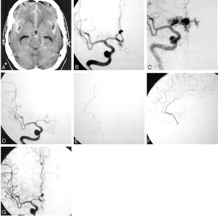 Fig 2.