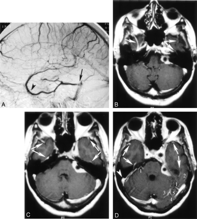 Fig 12.
