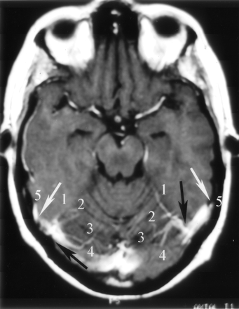 Fig 5.