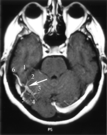 Fig 8.