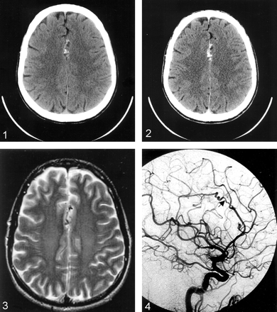 Fig 4.