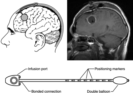 Fig 1.