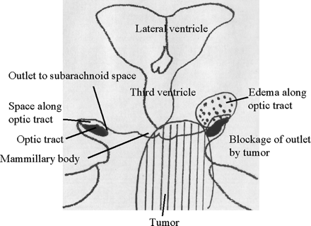 Fig 6.