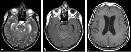 Fig 2.