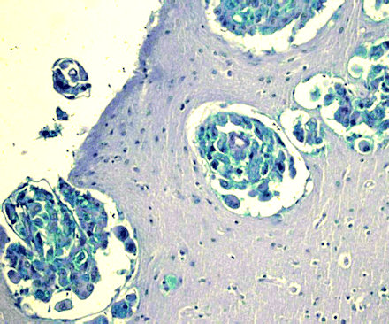 Fig 3.