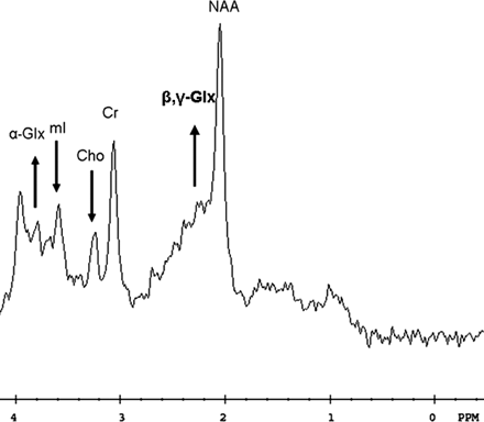 Fig 2.