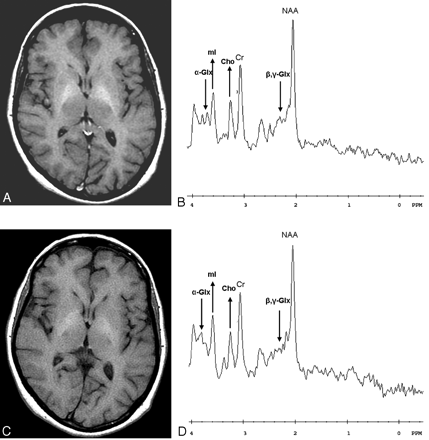 Fig 4.