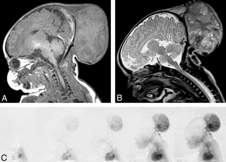 Fig 3.