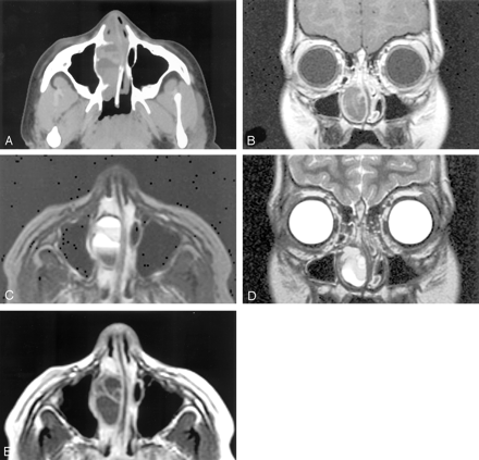 Fig 1.