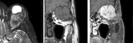 Fig 2.