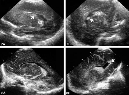 Fig 8.