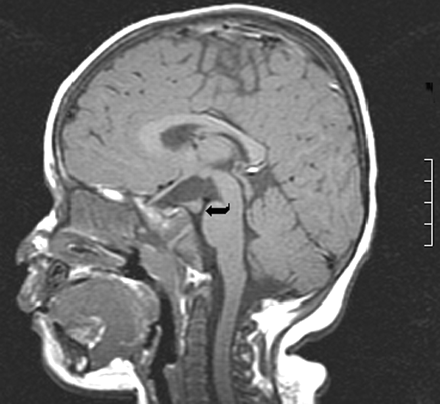 Fig 1.