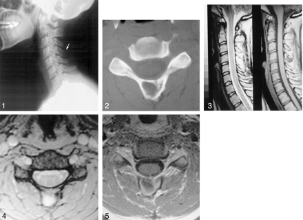Fig 4.