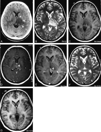 Fig 1.