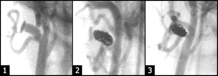 Fig 2.