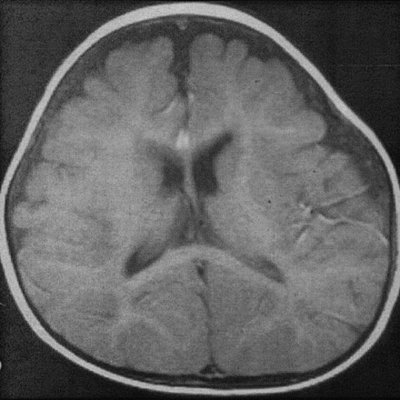 Fig 2.