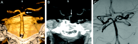 Fig 3.