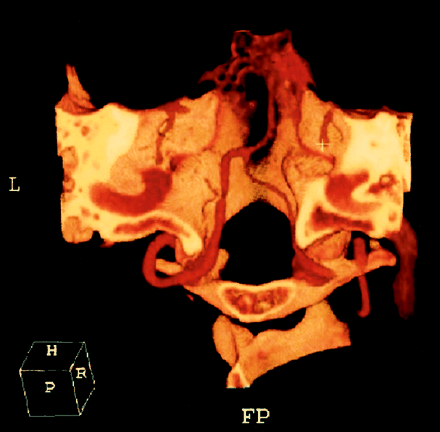 Fig 1.