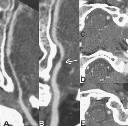 Fig 2.