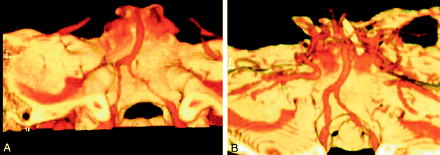 Fig 3.