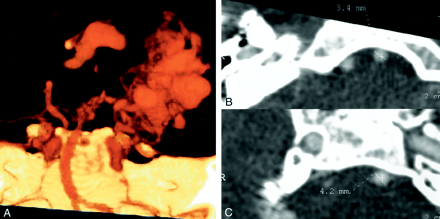 Fig 5.