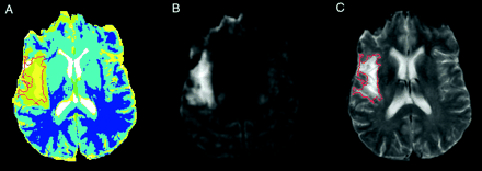 Fig 2.
