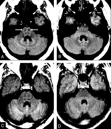 Fig 5.