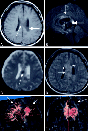 Fig 1.