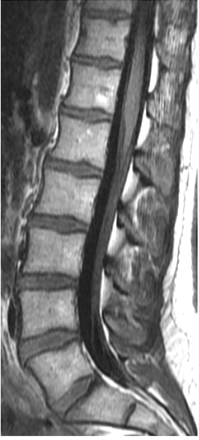 Fig 4.