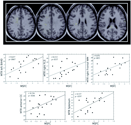 Fig 3.