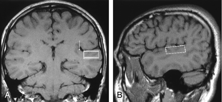 Fig 1.