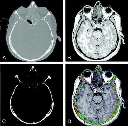 Fig 1.