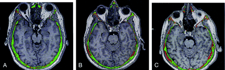 Fig 3.