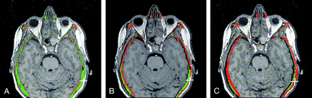 Fig 6.