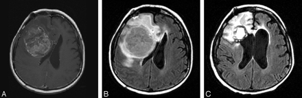 Fig 1.
