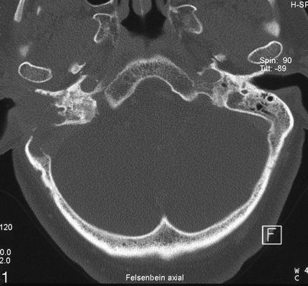 Fig 1.