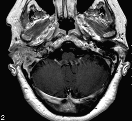 Fig 2.