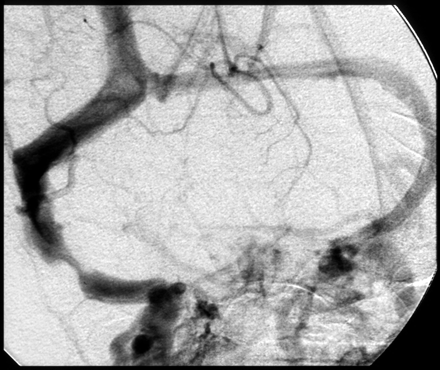 Fig 3.