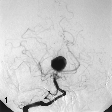 Fig 1.