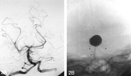 Fig 2.