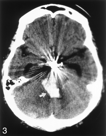 Fig 3.