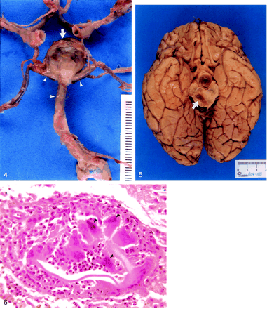 Fig 6.