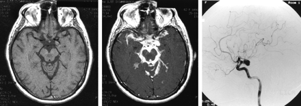 Fig 1.
